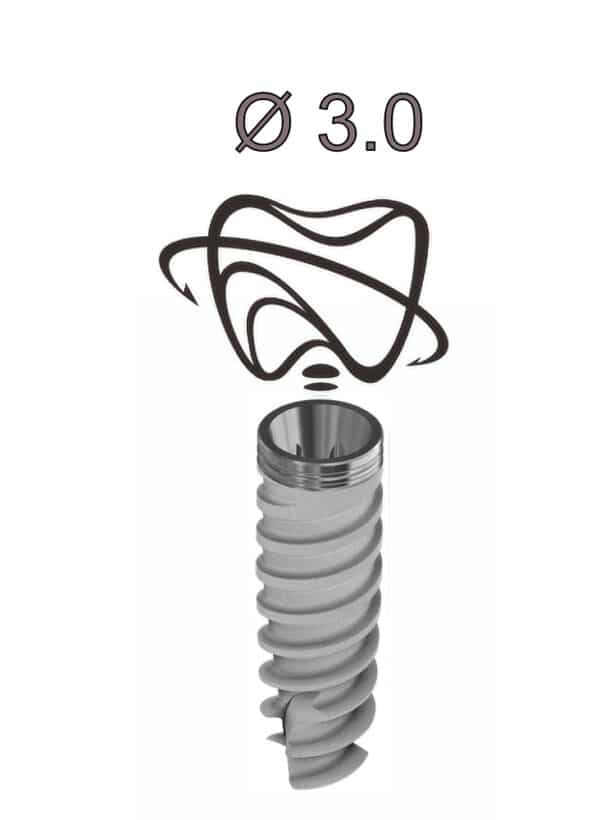 Implant Active Hex 3.0. Dess Dental implantat