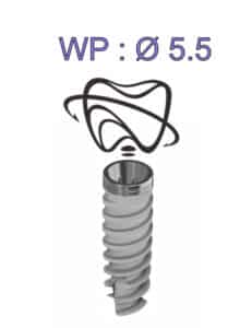 Implant Active Hex WP. Dess Dental implantat